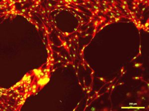 Eine Fluoreszenz-Aufnahme von dreidimensional gedruckten Knochenzellen. Die Zellkerne sind grün, das Zellskelett ist rot. (Bild: FAU)