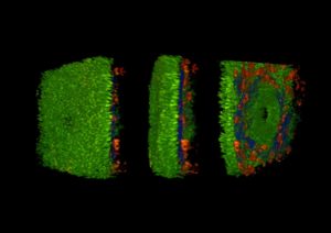 Eine Darmschleimhaut, wie sie sich durch das Multiphotonen- Mikroskop darstellt: Grün ist die reguläre Oberfäche der Darmschleimhaut, die Ephitelzellschicht, blau die Kollagenmatrix, rot sind Immunzellen, die in bestimmter Zahl auf Entzündungsreaktionen hinweisen können. (Bild: FAU)