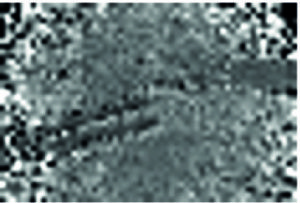Auch diese Abbildung zeigt exemplarisch ein im Rahmen der experimentellen Auswertung aufgenommenes Farbbild eines Leberphantoms sowie das zugehörige Tiefenbild. (Bild: FAU)