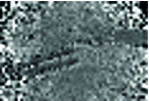 Auch diese Abbildung zeigt exemplarisch ein im Rahmen der experimentellen Auswertung aufgenommenes Farbbild eines Leberphantoms sowie das zugehörige Tiefenbild. (Bild: FAU)