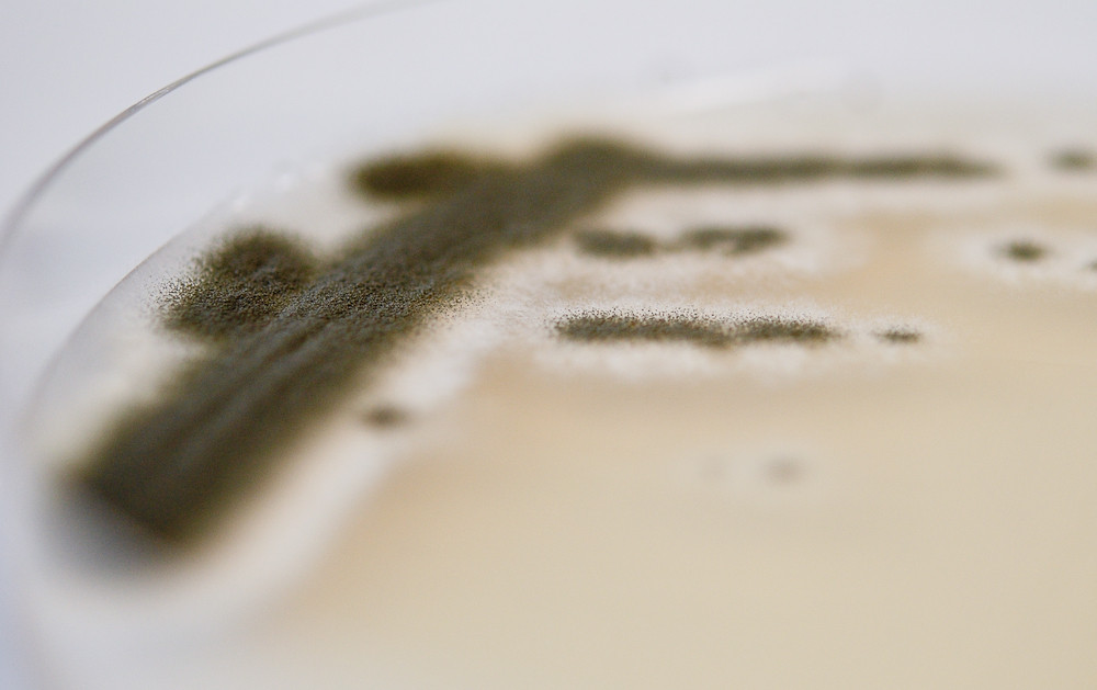 Der Schimmelpilz Aspergillus fumigatus kann bei Menschen mit geschwächtem Immunsystem schwere Krankheiten auslösen. (Bild: FAU)