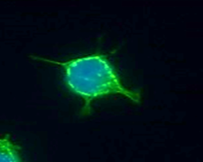 Zum Artikel "FAU-Forscher entschlüsseln Schutzmechanismus eines Tumorvirus"