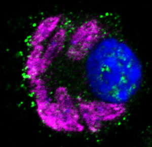 Macrophages in the presence of TNF 