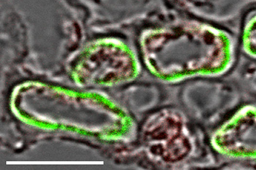 Das Bild zeigt den Querschnitt durch eine kleine Blattader aus einem Blatt einer Zuckerrübenpflanze nach Behandlung mit einem Antikörper gegen das BvSUT1 Protein. Der Antikörper markiert die 5 Geleitzellen in dieser Blattader grün. Die drei kleineren Siebelemente werden nicht markiert, besitzen also kein BvSUT1 Protein. Der weiße Balken entspricht der Größe von 10 µm. (Bild: WILEY Blackwell)