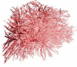 Dreidimensionale Aussprossung von Blutgefäßen aus einer arteriovenösen Gefäßschleife (kräftiges Gefäß in der Mitte des Gefäßbaums) in einer Fibrinmatrix. Die Biomatrix und die darin befindlichen Zellen und Moleküle werden neuerdings gedruckt.