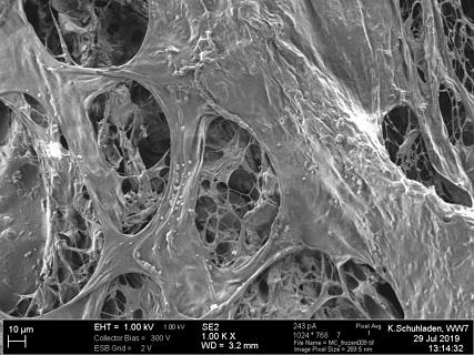 Rasterelektronenmikroskop-Aufnahme von humanen dermalen Fibroblasten, kultiviert auf gefriergetrockneten Zellulose-Schäumen.