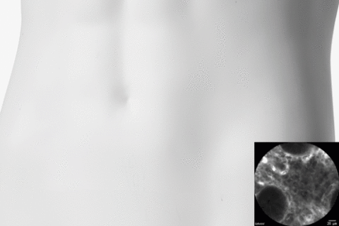 Abdomen einer Schaufensterpuppe und Bildgebungsbild einer Darmendoskopie