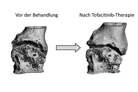 JAK-Inhibierung