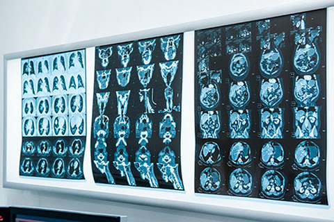 Röntgenbilder Kopf