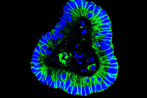 Das Bild zeigt den engen Zellzusammenhalt von Darmzellen (blau) über Zell-Zell-Interaktionsmoleküle (grün). (Bild: Uni-Klinikum Erlangen)