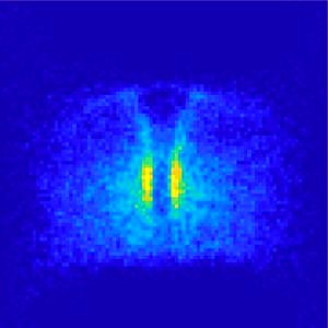 Mit einer neu entwickelten Software legten Wissenschaftler Mikroskopiebilder von Hunderten Zebrafischembryonen digital übereinander. So konnten sie Muster darin erkennen, wie sich Urkeimzellen bei Abwesenheit des Lockstoffrezeptors Cxr4b verhalten, und stellten fest, dass Gewebe an der Längsachse der Embryonen als physikalische Barriere fungiert: Es beeinflusst die Bewegungsrichtung der Zellen und verhindert, dass die Zellen durch das Gewebe hindurchwandern.