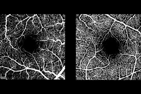 Angiografie-Bild