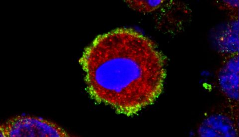 Mikroskopische Aufnahme einer kultivierten Darmepithelzelle deren Zelltodprogramm aktiviert ist (rot). Es bilden sich Poren in der Zellmembran (grün) wodurch die Zelle stirbt. Der Zellkern ist in blau dargestellt.