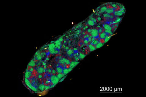 Lymphknoten einer an SLE erkrankten Maus