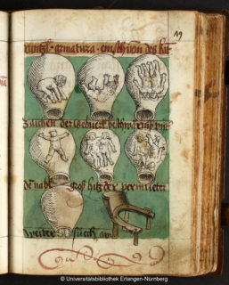 Gesundheit, Chirurgie und Geburtshilfe werden in der Bildenzyklopädie ausführlich im Bild beschrieben. (Bild: Erlangen, Universitätsbibliothek MS. B 200, f. 79r)