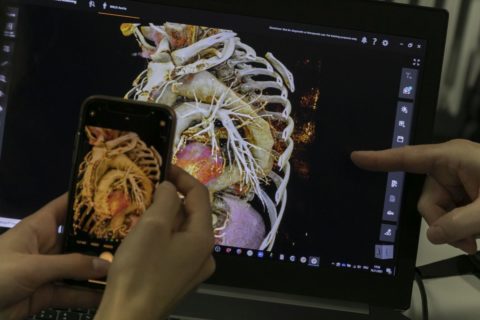 Mit einer Lernsoftware betrachten die Studierenden fotorealistische 3D-Rekonstruktion von medizinischen Bilddaten (MRT / CT). (Bild: FAU/Giulia Iannicelli)