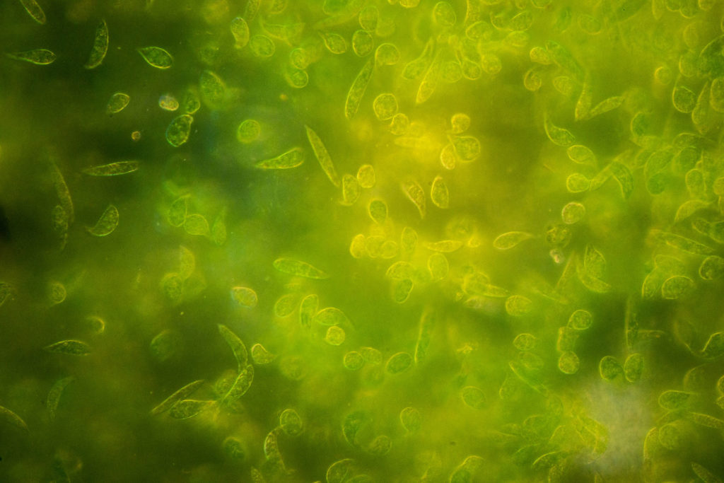 Eine Mikroskop-Aufnahme zeigt hellgrüne Euglena.