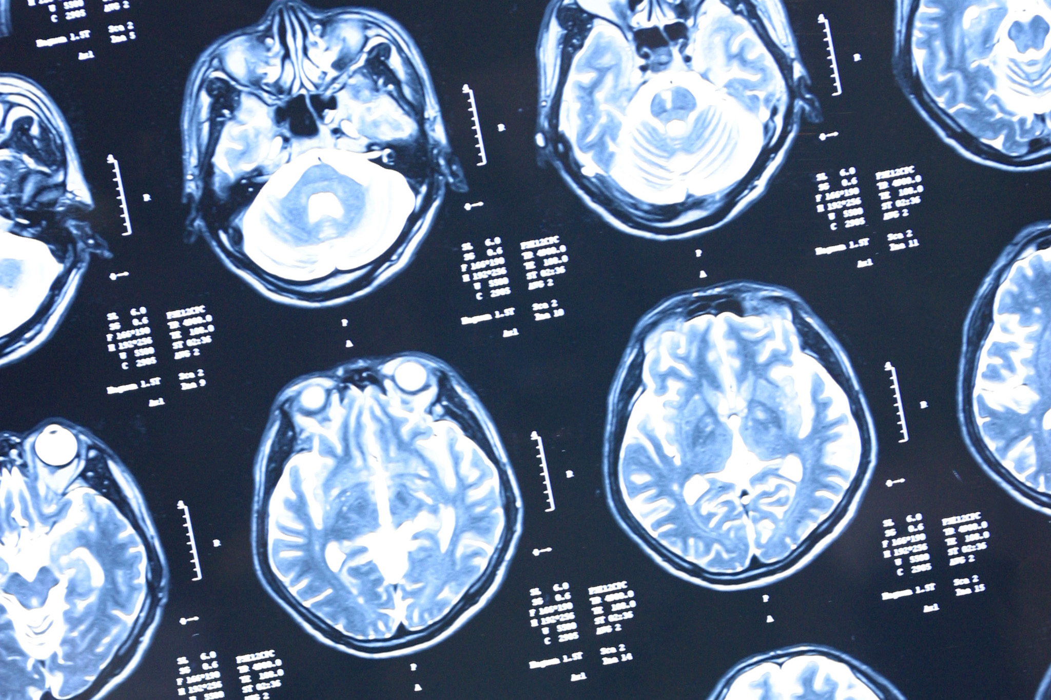 Bild: Bildagentur PantherMedia/TongRoFoto Lewis Lee