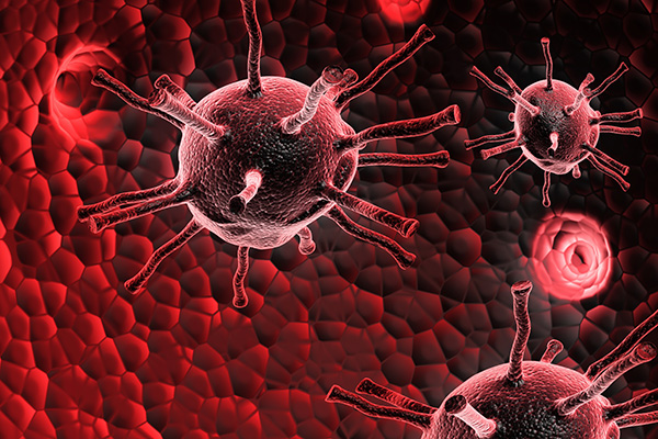 Bauchspeicheldrüsenkrebs – neue Erkenntnisse ermöglichen Behandlungsfortschritt