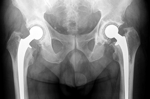 3D-Dunkelfeld-Rekonstruktionen mit dem Röntgengerät