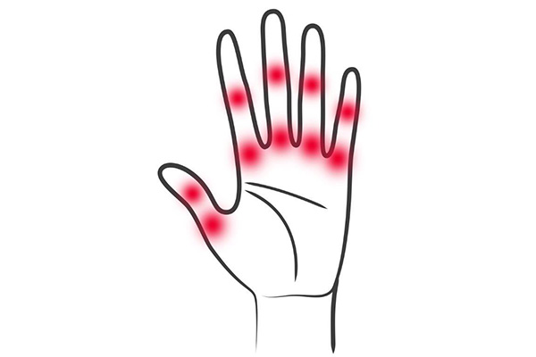 Schaltstelle zur Entzündungsauflösung identifiziert