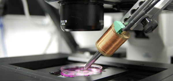 Wie bringen sich Zellen nach Krafteinwirkung wieder in Form?