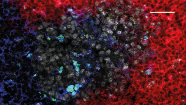 Zuckerketten schützen vor Autoimmunerkrankungen