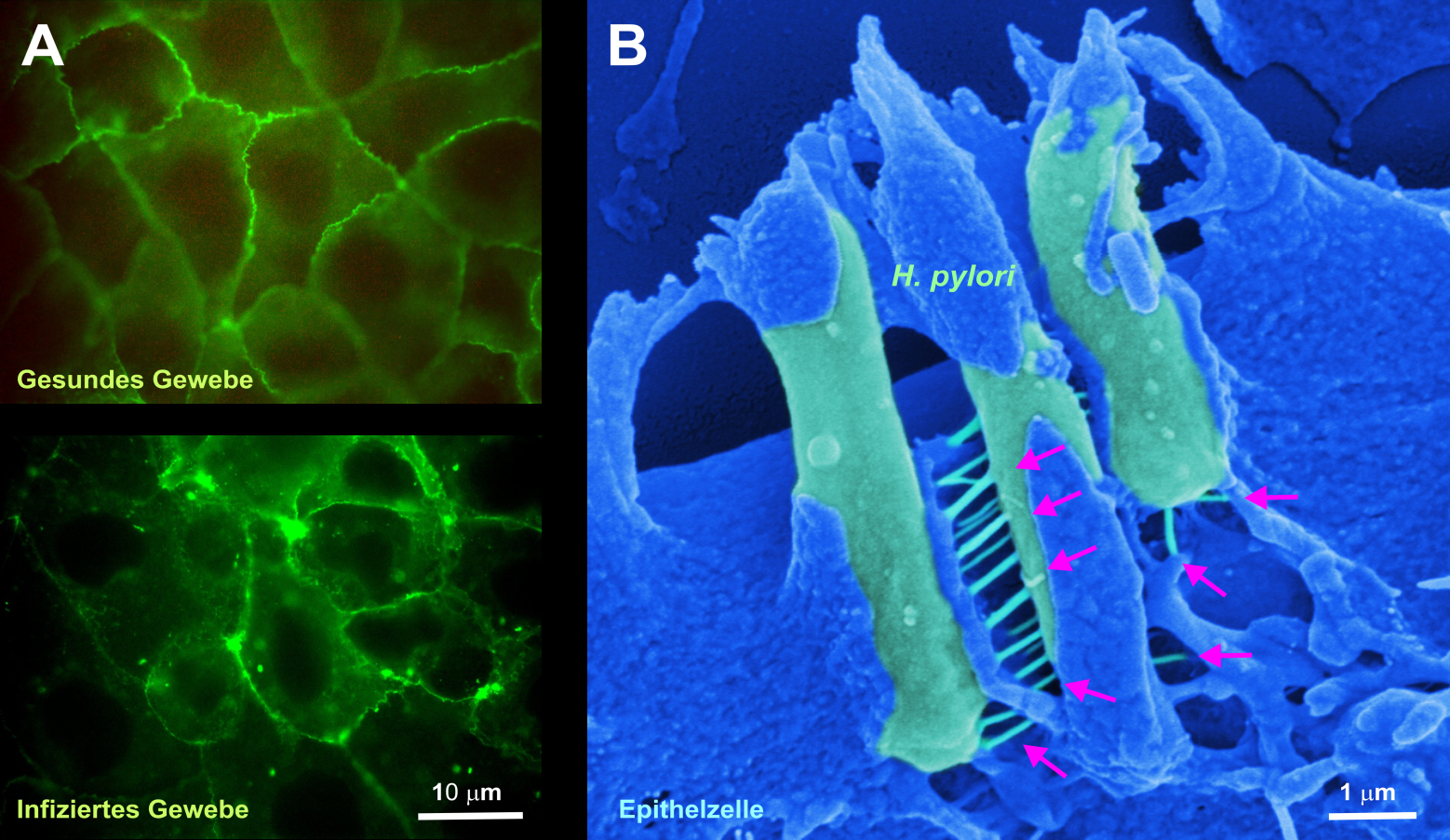 Helicobacter pylori Bakterien