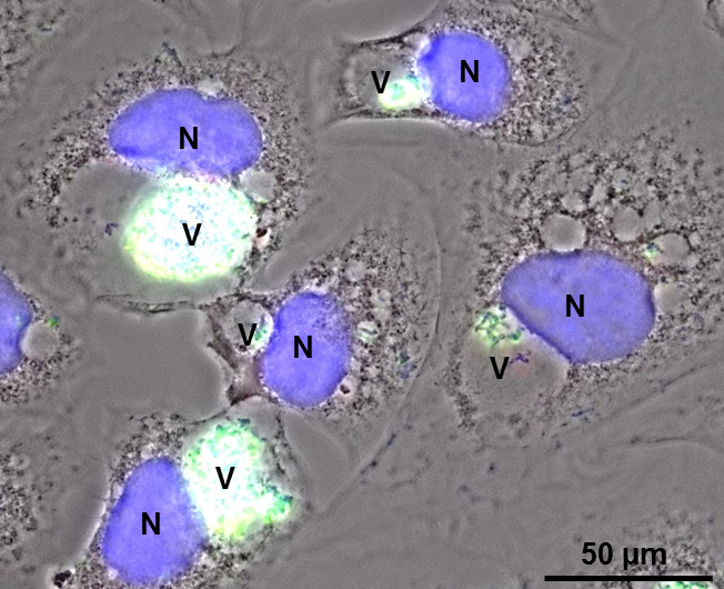 Wenn Schafe und Ziegen für Menschen zur Gefahr werden