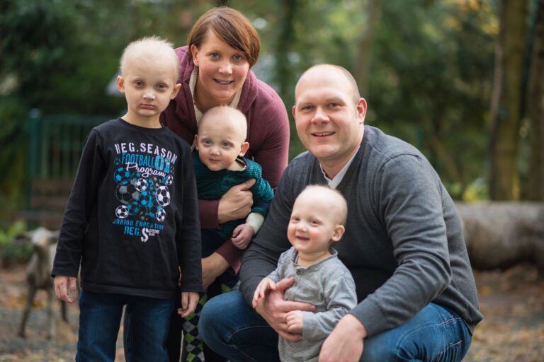 Weltweit erste erfolgreiche Therapieversuche bei Erbkrankheit Ektodermale Dysplasie