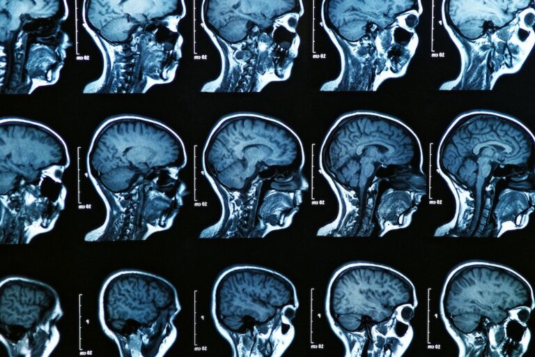 Zwischen  Leben und Tod