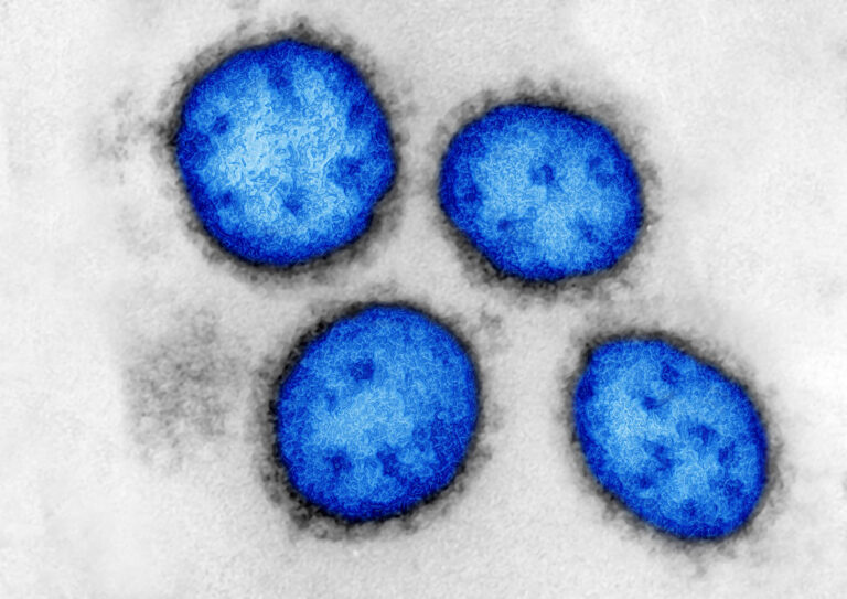 Leisen Killern auf der Spur