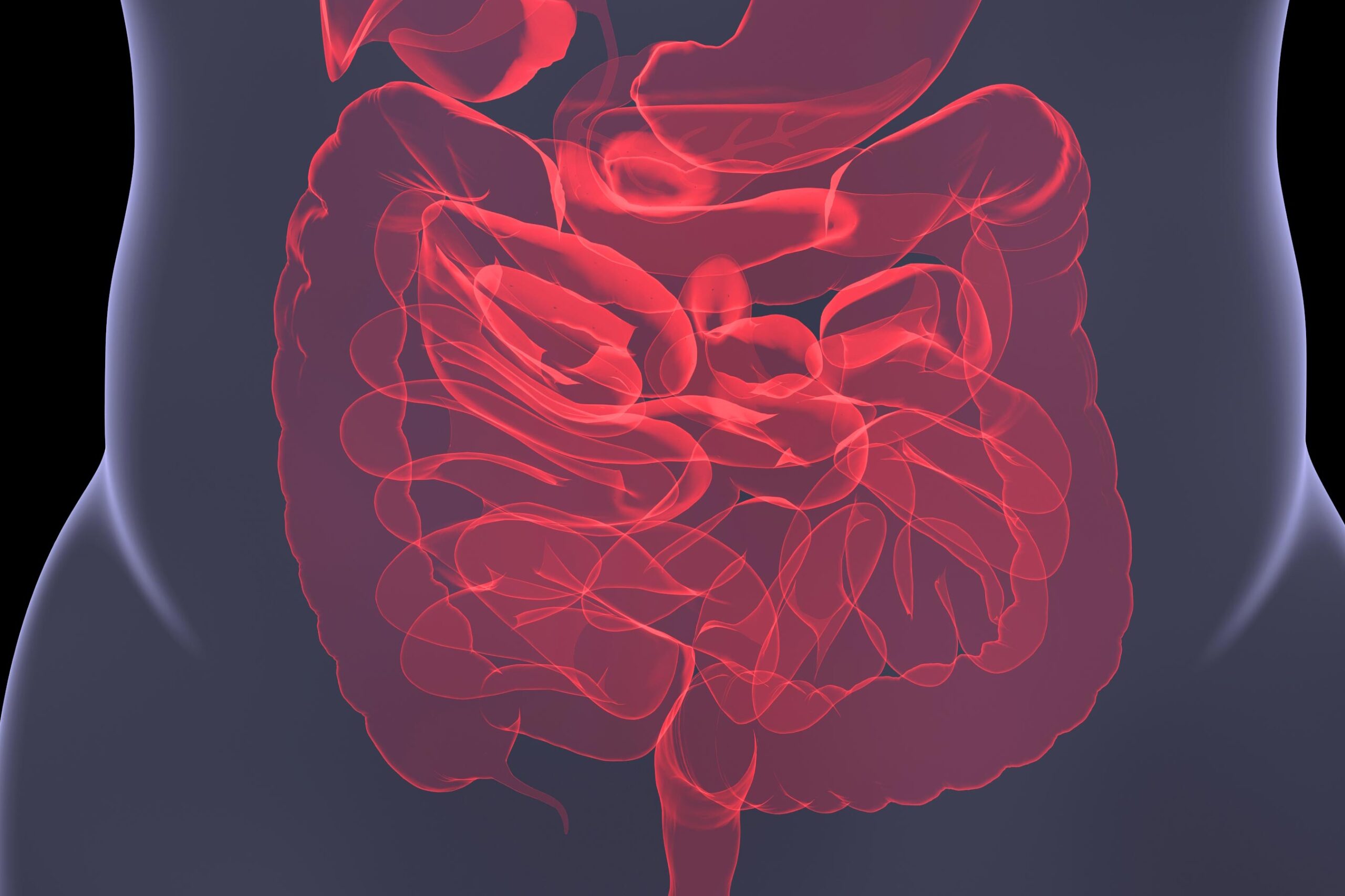 Eine grafische Röntgendarstellung des menschlichen Darms.