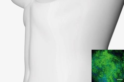 Endo-Mikroskopie: Gewebediagnose ohne künstliche Kontrastmittel