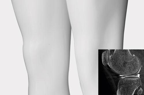 Computertomografie: Scannen unter Volllast