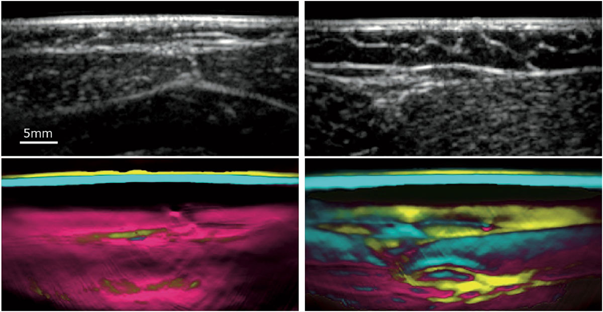 Aufnahmen mit Ultraschall und MSOT.