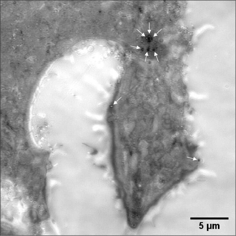 „Coronaskop“ ermöglicht Live-Beobachtung einer Covid-19-Infektion