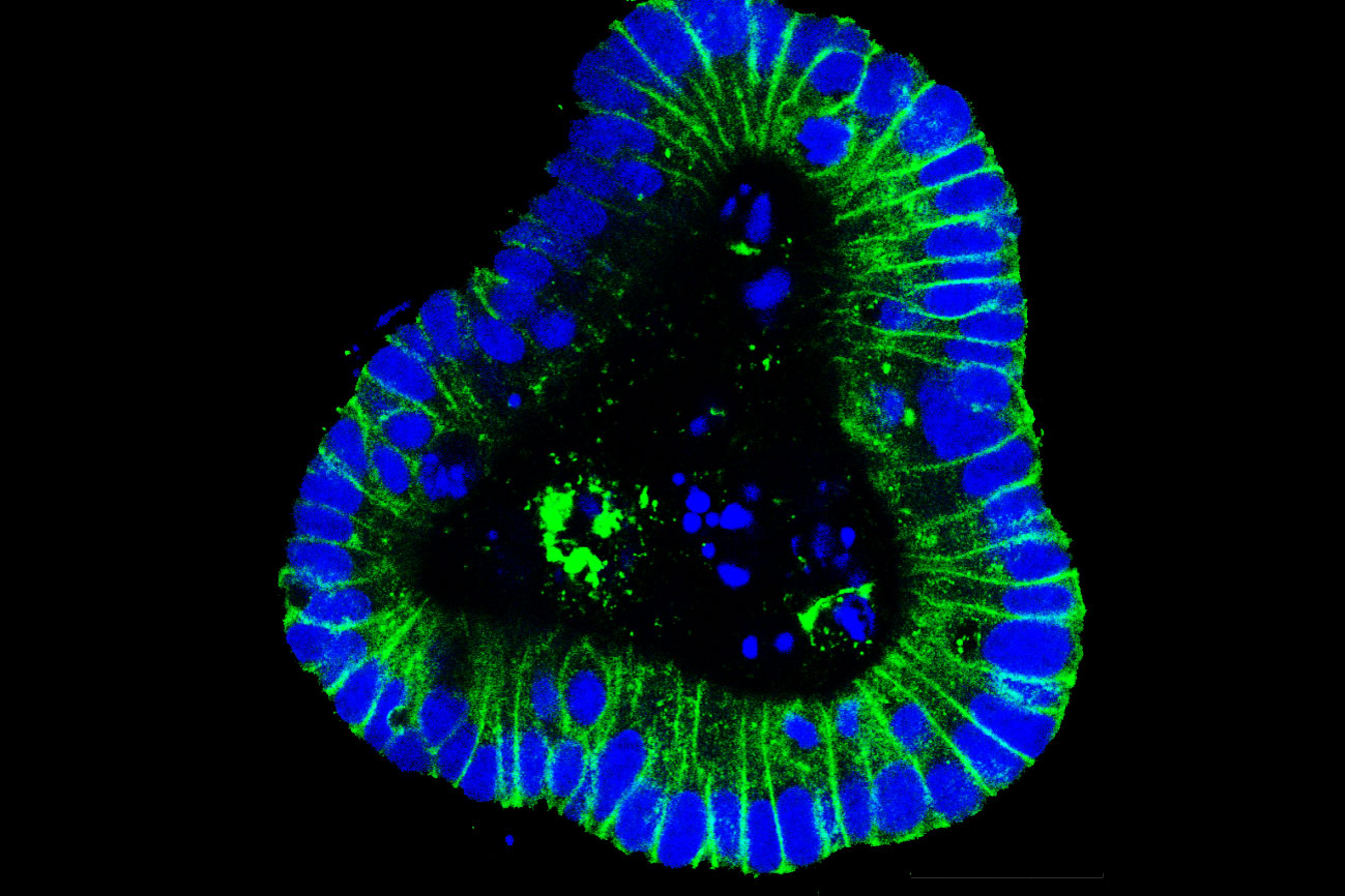 Das Bild zeigt den engen Zellzusammenhalt von Darmzellen (blau) über Zell-Zell-Interaktionsmoleküle (grün). (Bild: Uni-Klinikum Erlangen)