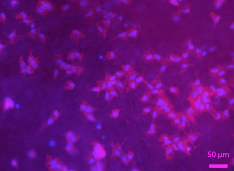 Neue Regenerationsansätze bei Sehnenverletzungen