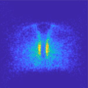 Mit einer neu entwickelten Software legten Wissenschaftler Mikroskopiebilder von Hunderten Zebrafischembryonen digital übereinander. So konnten sie Muster darin erkennen, wie sich Urkeimzellen bei Abwesenheit des Lockstoffrezeptors Cxr4b verhalten, und stellten fest, dass Gewebe an der Längsachse der Embryonen als physikalische Barriere fungiert: Es beeinflusst die Bewegungsrichtung der Zellen und verhindert, dass die Zellen durch das Gewebe hindurchwandern.