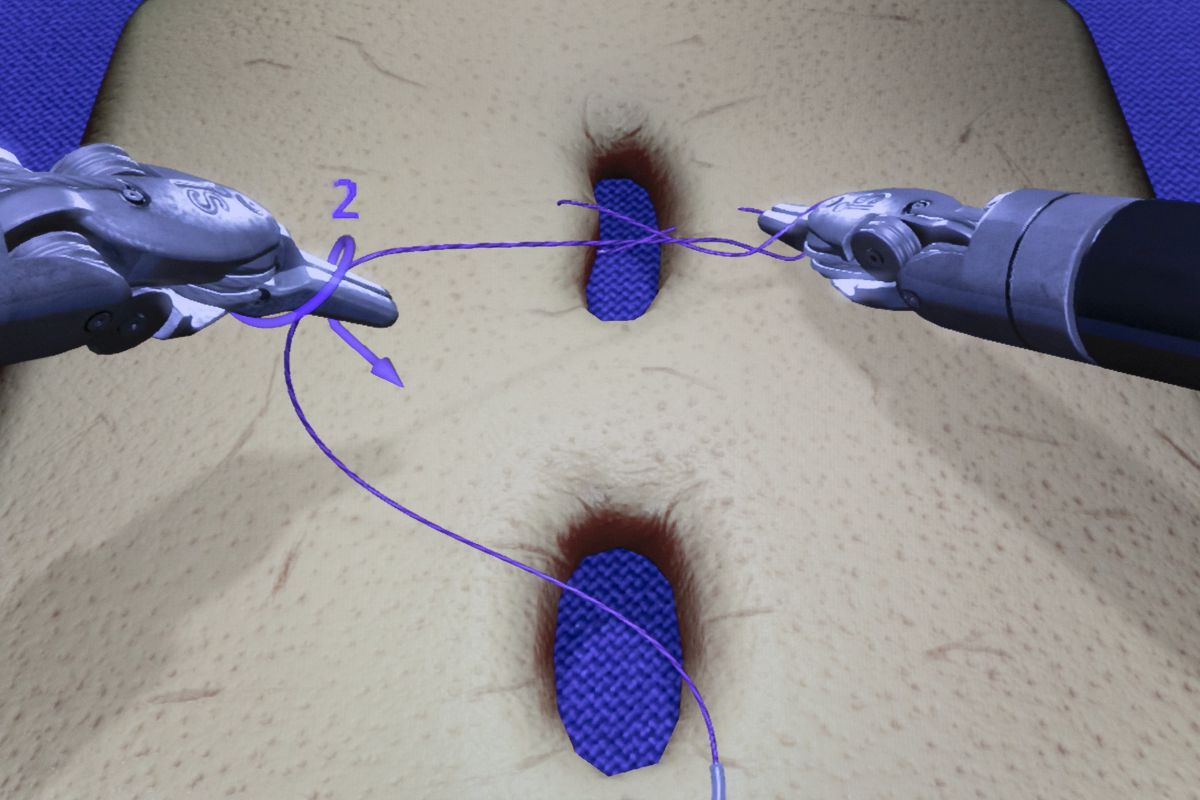 Screenshot einer Nahtübung aus dem Simulator.