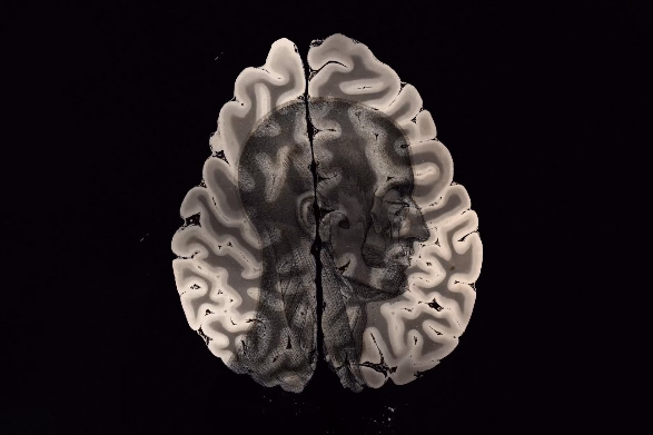 Multimediales Konzert zum Gehirn am 21. September