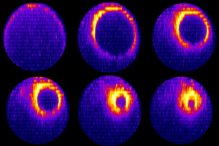 Zellforschung: Aus Eins mach Zwei in 20 Minuten