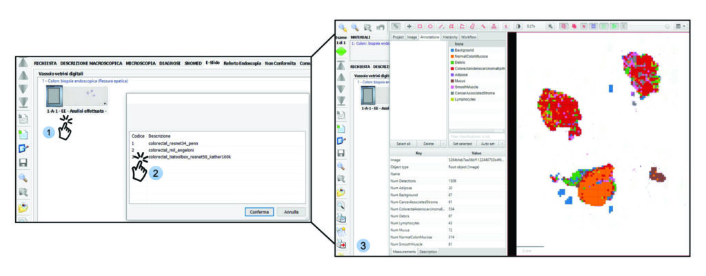 Visualisierung von Deep-Learning-Modellvorhersagen direkt aus dem Laborinformationssystem. Nach erfolgreichem Abschluss der Analyse können Pathologen auf den Schnitt klicken (1), diejenigen Modelle auswählen, deren Resultate visualisiert werden sollen (2) und sich die Ergebnisse als farbige Heatmap (3) anzeigen lassen.