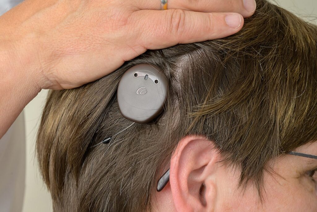Kopf mit Cochlea-Implantat