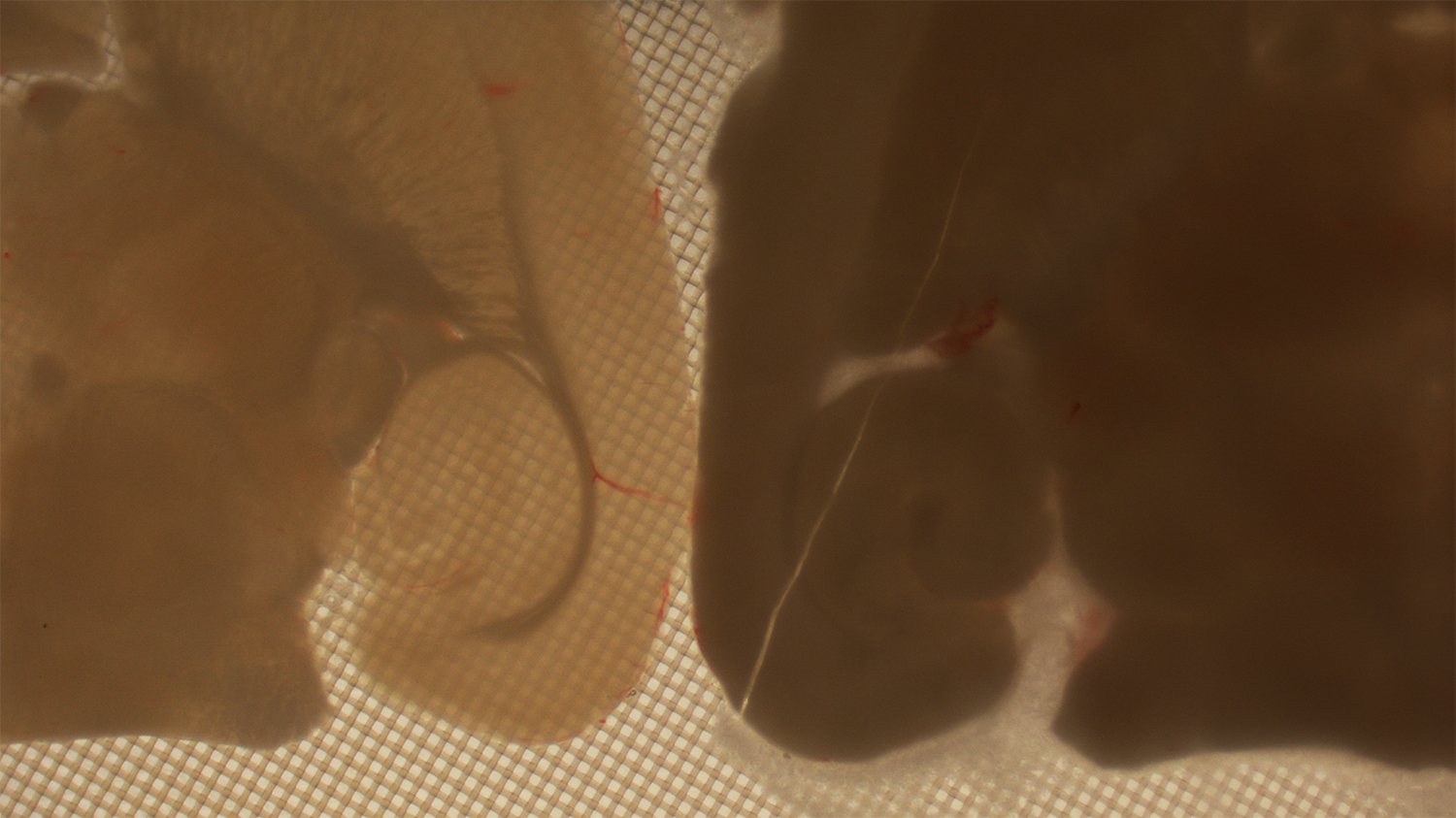 FAU Kryogenik: Die stereomikroskopischen Aufnahmen zeigen Hirnschnitte bei -160 Grad Celsius.