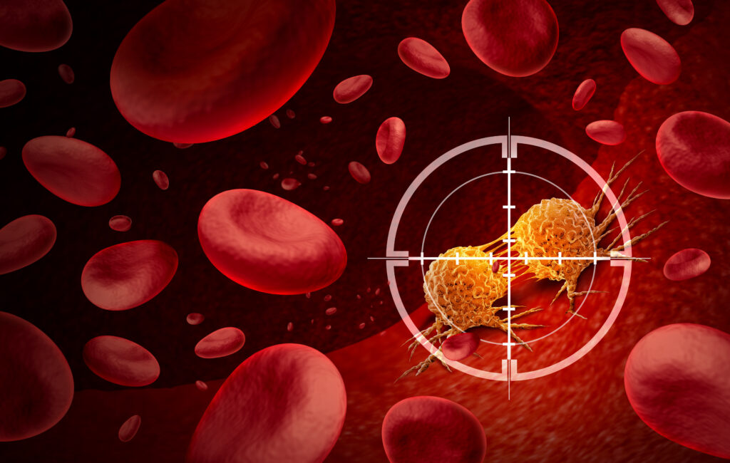Blutzellen und Lymphome, Fadenkreuz ist auf Lymphome gerichtet.